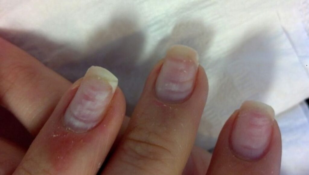 Como salen los aros de fuego en las uñas