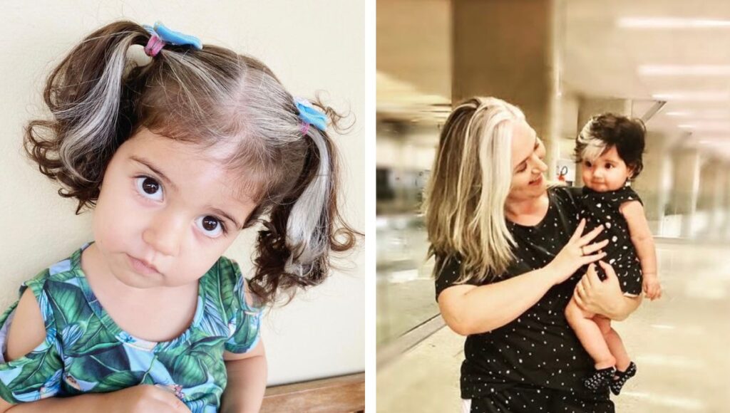 por qué nacen bebés con canas