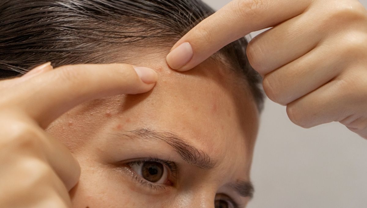Consejos para quitar espinillas
