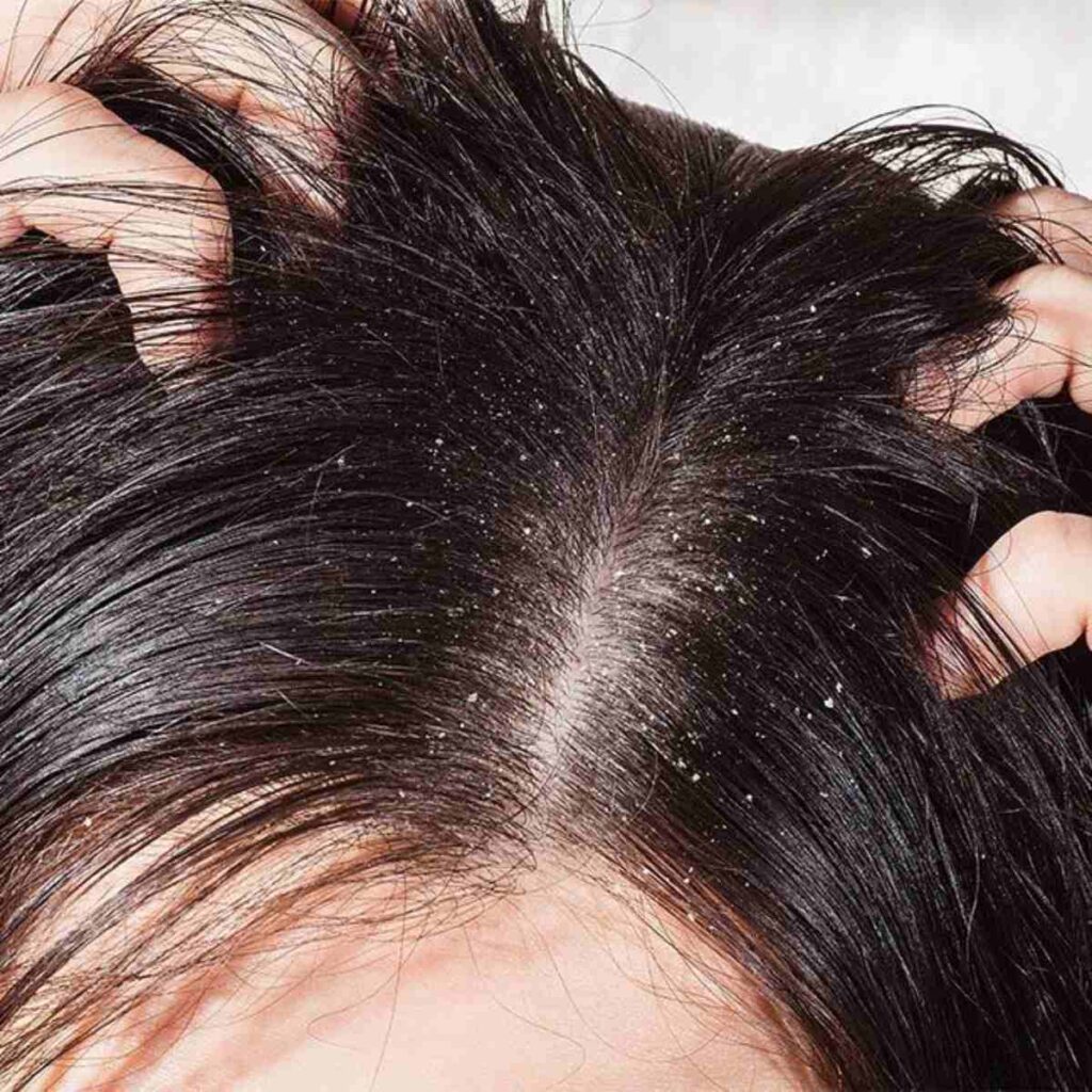 Cómo se prepara el romero para hacer crecer el cabello