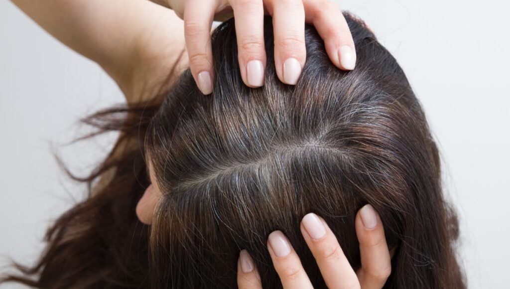 por qué tengo canas a temprana edad