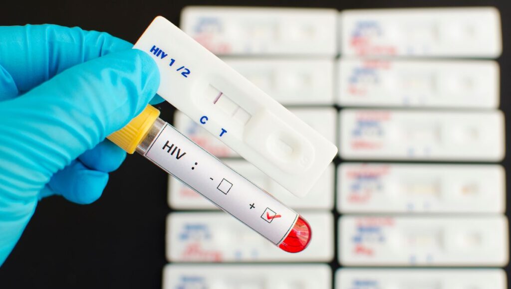 ¿Qué es el PrEP, las pastillas de la UNAM y el IMSS para prevenir el VIH?