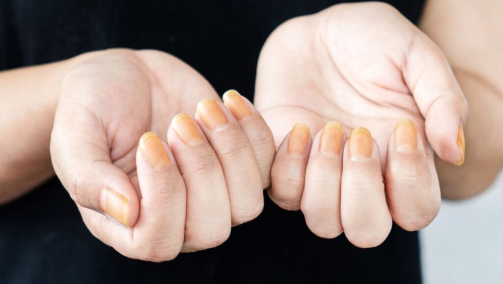 cuando quitar el esmalte de uñas