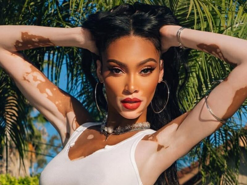 Cuándo se conmemora el Día del Vitiligo