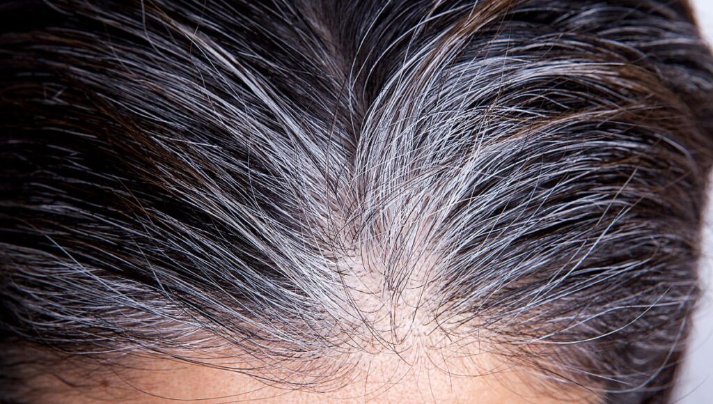 Relación entre las canas y el estado de salud