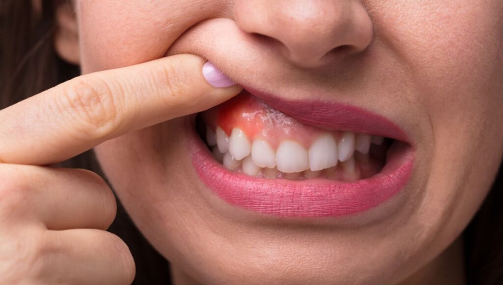 Que daños ocasiona la pasta Colgate Total Clean Mint