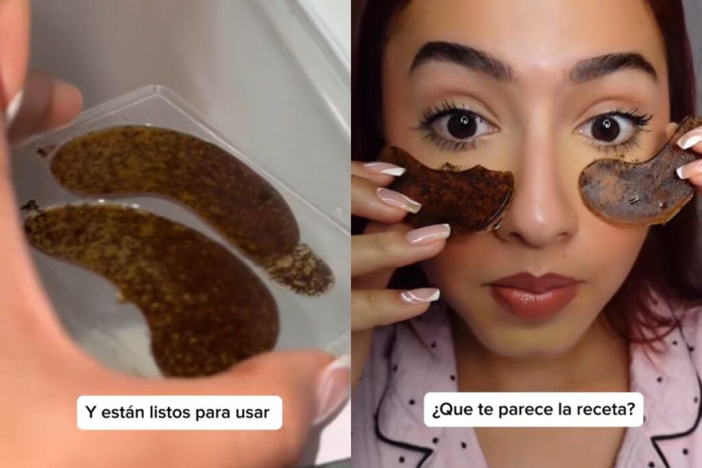 como elimino las bolsas de los ojos 
