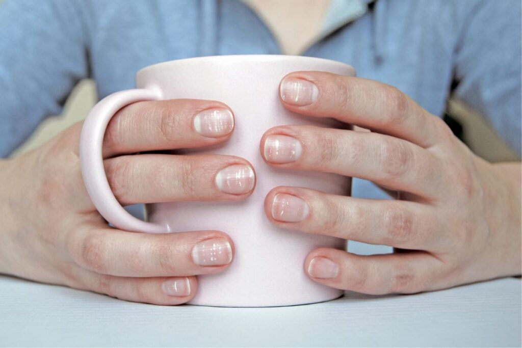 como quitar las manchas de las uñas