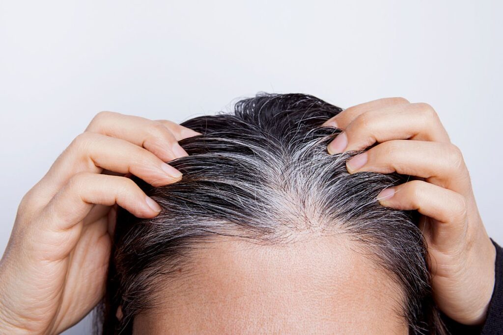 que puedo hacer para que no me salgan mas canas 
