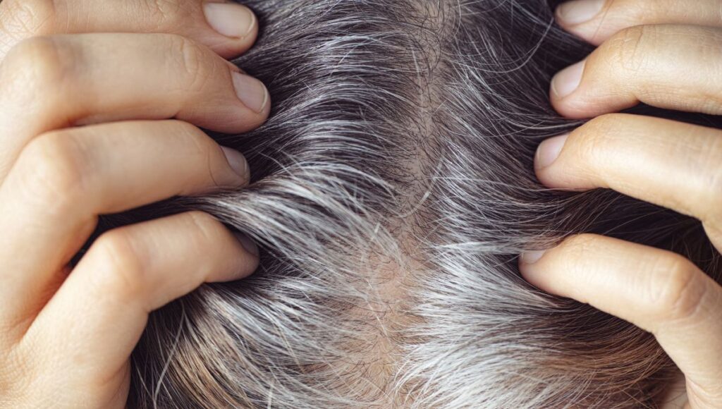 ¿Por qué salen las canas verdes?