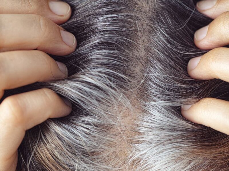 ¿Por qué salen las canas verdes?