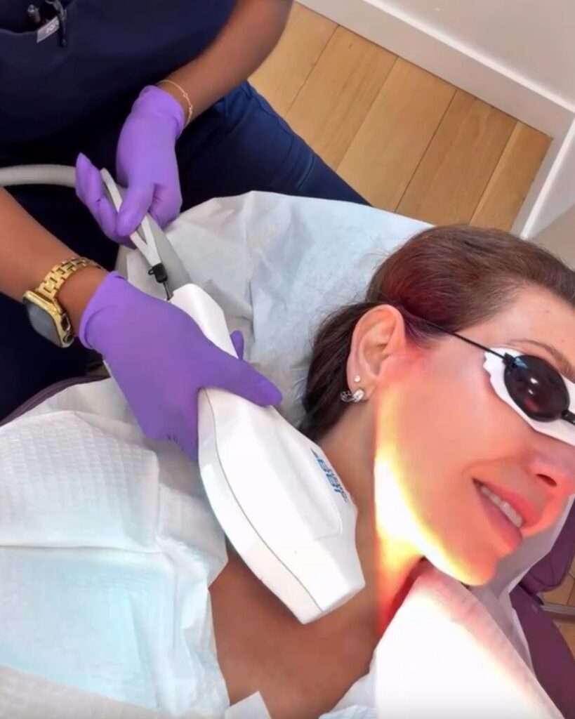 tratamientos esteticos para eliminar la papada 
