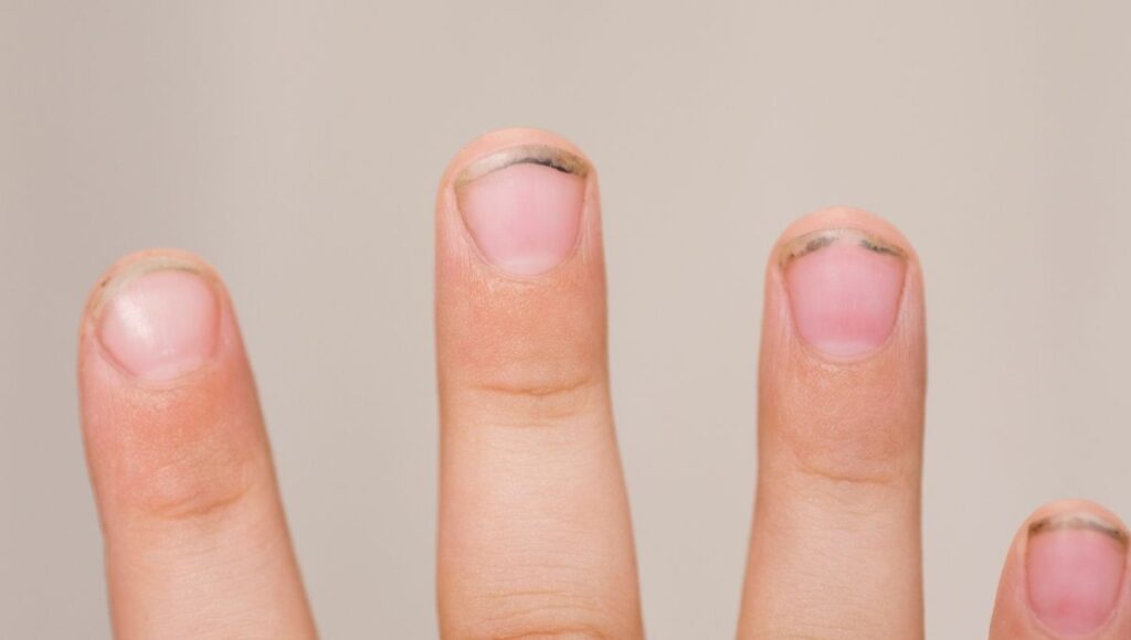 Hongos y bacterias en las uñas largas